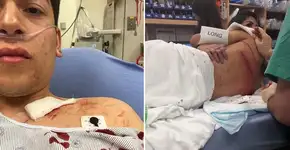 Casal gay é esfaqueado enquanto passeava de mãos dadas