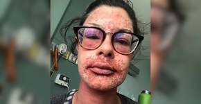 Foto: (Arquivo pessoal)